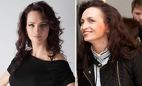 Jurga Anusauskienė po plastinės akių vokų operacijos