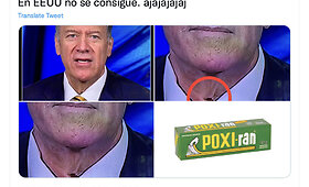 Mike'o Pompeo i&scaron;vaizdos pokyčiai