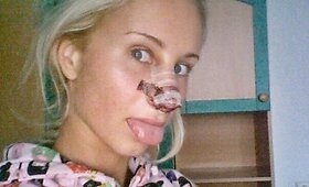 Kristina Tarasevičiūtė pripažino pasidariusi nosies rekonstrukciją