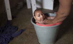 Zika viruso padariniai Brazilijoje