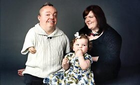 Nukentėjęs nuo talidomido Kevinas Donnellonas su &scaron;eima