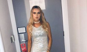 Kojos protezą ne&scaron;iojanti britė Bernadette Hagans