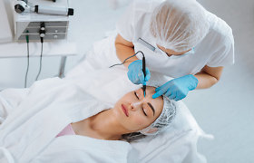Be adatų ir skalpelio: ką gali populiarios nechirurginės procedūros, skirtos veido odai jauninti?