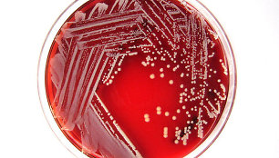 Staphylococcus lugdunensis bakterija