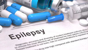 Diagnozė &ndash; epilepsija.