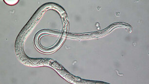 Strongyloides stercoralis, mastelio žymeklio dydis &ndash; 30 mikrometrų