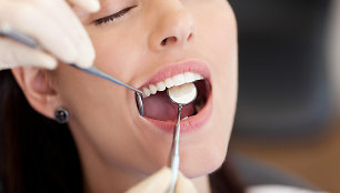Specialios balinančios dantų pastos  gali pašviesinti jūsų dantis, bet jei norite geresnio efekto, kreipkitės į odontologą.