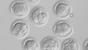 Besivystantys žmogaus embrionai, kuriuose panaudota DNR iš odos ląstelių, trečiąją vystymosi dieną. 