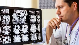 Daktaras žiūri į galvos rentgeno nuotraukas