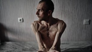Rusų nelaisvėje buvę ukrainiečiai neteko po 40 kg svorio