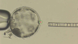 Į kiaulės embrioną švirkščiamos žmogaus ląstelės