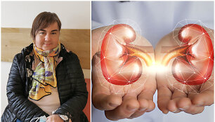 Rūta Ardinavičienė sulaukė kasos ir inksto komplekso transplantacijos