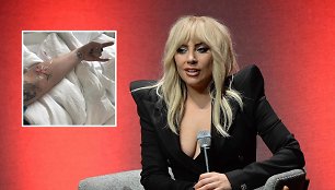 Lady Gaga dėl didelių skausmų paguldyta į ligoninę