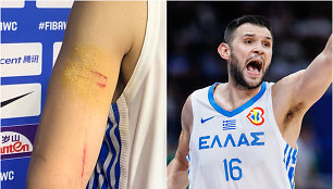 Kostas Papanikolaou ir jo apdraskyta ranka