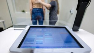 Mamografijos tyrimas padeda nustatyti ankstyvą krūties vėžį.