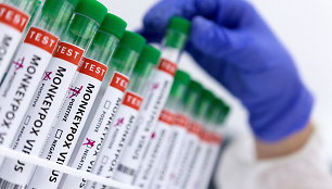 SAM: per artimiausias savaites Lietuvą pasieks 700 vakcinos nuo beždžionių raupų dozių