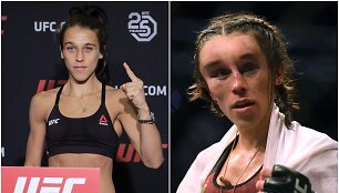 J.Jedrzejczyk veidas deformavosi per kovą.