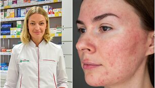 Farmacininkė Fausta Barisevičienė &ndash; apie odos erkutes