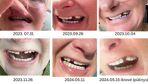 Nuotraukoje užfiksuotos dantų problemos, kilusios skaitytojai Aušrai