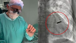 &bdquo;Azovstal&ldquo; gynėjui i&scaron; &scaron;irdies i&scaron;imta kulka