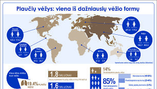 Plaučių vėžio statistika gąsdina labiausiai