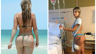 Andressa Urach