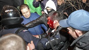 Donecke sužeistas protestuotojas