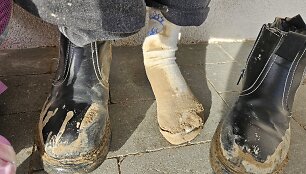 Aidos duktė antrokė pirmą kartą ėjo i&scaron; mokyklos savaranki&scaron;kai. Tokios jos kojos buvo po kelionės žvyrkėliu