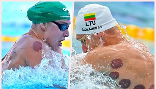 Europos plaukimo čempionate dalies plaukikų, tarp jų Rūtos Meilutytės ir Andriaus Šidlausko, kūnus žymi vaakuminių taurių paliktos žymės. 