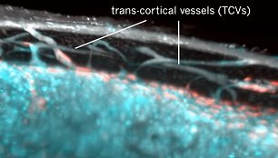 Trans-kortikalinės gyslos