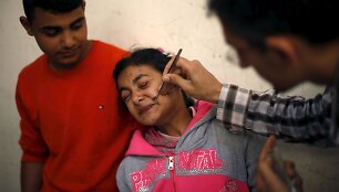 Bičių įgėlimų terapija Palestinoje gydomi pacientai