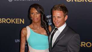Turia Pitt ir Michaelas Hoskinas