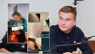 Paulius Ar&scaron;auskas galimai sužalojo merginą