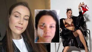 Skaistė Mood