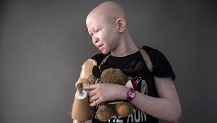 Į Niujorką i&scaron; Tanzanijos atgabenti albinosai