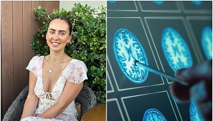 24 metų paramedikei Hannah auglys smegenyse rastas tik po 6 vizitų pas gydytoją