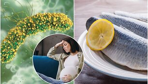 Listeria monocytogenes sukeliama infekcija ypač pavojinga nė&scaron;čiosioms ir naujagimiams