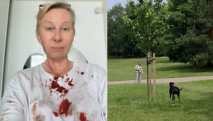 Jurga Varanavičius prabilo apie i&scaron;puolį