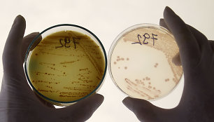 E.coli bakterijos tyrimai