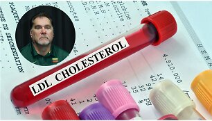 Arvydas Sabonis kviečia reguliariai tikrintis kraujospūdį ir cholesterolio kiekį kraujyje