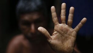 Banglade&scaron;o valdžia nesiima priemonių i&scaron;spręsti arseniku užter&scaron;to vandens problemos