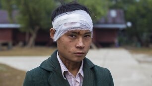 Aguonų augintojų užpultas jaunuolis