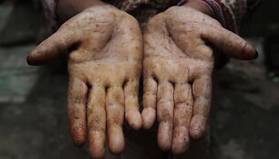 Banglade&scaron;o valdžia nesiima priemonių i&scaron;spręsti arseniku užter&scaron;to vandens problemos
