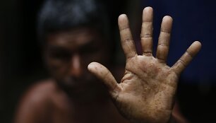 Banglade&scaron;o valdžia nesiima priemonių i&scaron;spręsti arseniku užter&scaron;to vandens problemos