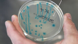 E.coli bakterijos tyrimai