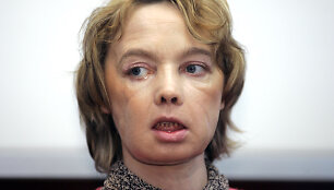 Isabelle Dinoire