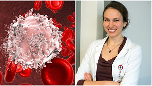 Hematologė Austėja Dapkevičiūtė-Purlienė pasakoja apie kraujo vėžį