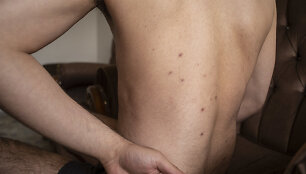 Protestuotojas Masoudas