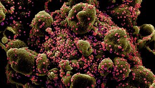 Vyksta ląstelės, prigaminusios gausybę SARS-CoV-2 viruso, apoptozė