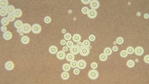 Grybelis Cryptococcus neoformans yra ne tik perspektyvi apsauga nuo jonizuojančios spinduliuotės, bet ir žinoma grėsmė asmenims su nusilpusiu imunitetu